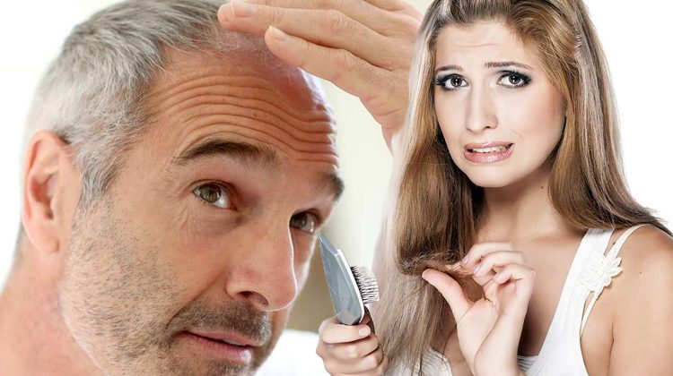 hair loss men women